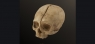 40smg-human-skull